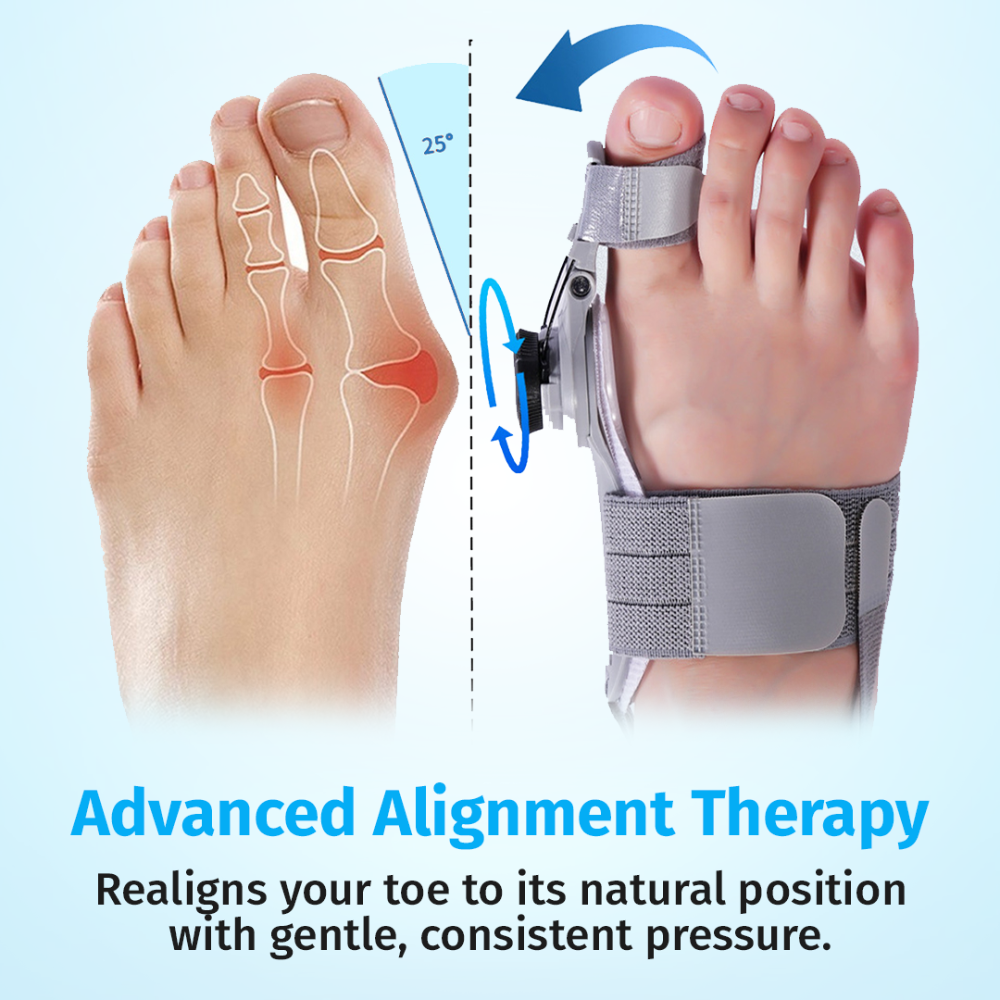 FlexiToe™ Alignment Support